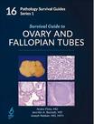 Survival Guide To Ovary And Fallopian Tubes