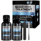 Tratamento de fungos OSIMOON Extra Strength para unhas dos pés, 2 pacotes