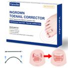 Tratamento Domiciliar para Unhas Encravadas Yanxifei - Com Corretor Nitinol