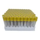 Tubo Coleta Sangue Vácuo Amarelo Gel 3,5ml 100un Tubo Coleta Sangue Vácuo Amarelo Gel 3,5ml 100un