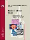 Tumors of the liver (afip atlas of tumor pathology series 4)