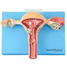 Útero com Trompas Patológico em Prancha, Anatomia