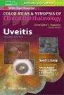 Uveitis, Autor: Sunir J. Garg Uveitis, Autor: Sunir J. Garg