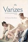 Varizes - conhecer para prevenir