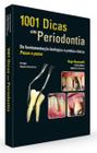 1001 dicas em periodontia - da fundamentação biológica à prática clínica passo a passo - Santos Publicações