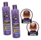 2 Shampoos fortificante dom