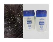 2X Shampoo fim do piolho-lêndeas e piolhos-