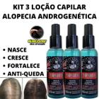 3 Tônico De Tratamento Capilar Contra Alopecia Androgenética