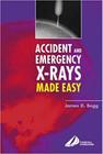 Accident and emgerency x-rays made easy - CHURCHILL LIVINGSTONE, INC.
