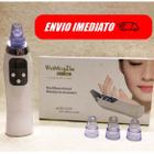 Aparelho Extrator de Cravo Multifuncional Limpa os Poros Aspirador a Vácuo Limpeza Facial Peling Remove Oleosidade