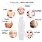 Aparelho Peeling Ultrassónico Portátil Lifting Limpeza Pele