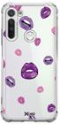 Case Bocas - Motorola: E6S