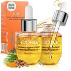 Conjunto de óleo de cabelo Giofna Rosemary Serum para crescimento de cabelo, 2 unidades