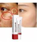 Creme Clareador Melasma Sardas Manchas 20g