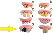 Dentadura latex monstro -8 modelos a escolher - dentes podres