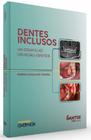 Dentes Inclusos – Um Desafio ao Cirurgião-Dentista - Santos Publicações -