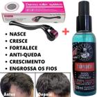 Derma Roller + Loção Nasce Cresce Fortalece O Bulbo Capilar!