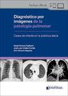 Diagnostico por imagenes de la patologia pulmonar