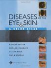 Diseases Of The Eye e Skin a Color Atlas - LIPPINCOTT WILLIAMS & WILKINS