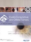 Eyelid, conjunctival, and orbital tumors - 2nd ed