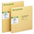 Filme Para Raio-X - Super Hr-U 15 X 40 Cm - Fujifilm