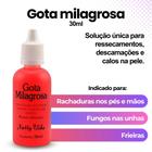 Gota Milagrosa - Tratamento para Rachaduras, ressecamento e descamações dos pés 30ml - Natty Vida