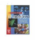 Hip Arthroplasty: Minimally Invasive Techniques And Computer Navigation, te