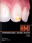 Hmi: hipomineralizacao de molares e incisivos - ED NAPOLEAO