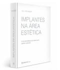 Implantes Na Área Estética – Uma Estratégia De Tratamento Passo-A-Passo - Editora Napoleão