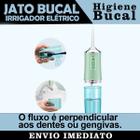 Irrigador Bucal Jato Fio Oral Limpa Aparelho Dental Slu Med