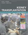 Kidney transplantation. principles and practice - W.B. SAUNDERS