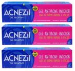 Kit Anti-Acne Lapiseira Secativa e Sabonete Atisséptica Acnase Seca e  Disfarça Cravos e Espinhas Linha Emergência - Antiacne - Magazine Luiza