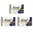 kit 3x acnol sabonete antiacne recomendado para evitar cravos espinhas reduzir oleosidades 80g