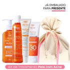 Kit Antiacne para Presente: Sabonete Gel 140g + Tônico + Gel Secativo de Espinhas + Protetor Solar FPS 30 Actine Darrow