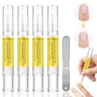 Kit com 4 Óleos de Crescimento de Unhas Grenben 2ml - Rejuvenescimento e Lixa