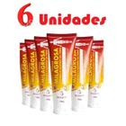 Kit com 6 Pomada Massageadora Milagrosa 150g