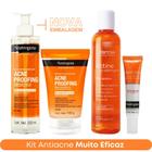 Kit Tratamento Antiacne: Sabonete + Esfoliante Acne Proofing + Tônico Adstringente Actine + Gel Secativo Neutrogena