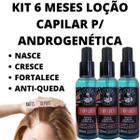 Kit Tratamento Capilar 3 Loção Anti Caspa,Seborreia Alopecia