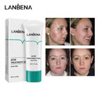 Lanbena azul na acne gel la-122