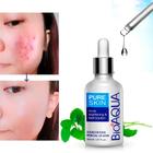 Limpeza facial Bioaqua Serum Pure Skin remove acne e bl