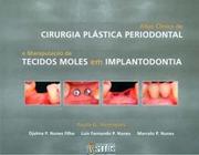 Livro - Atlas Clínico de Cirurgia Plástica Periodontal