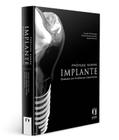 Livro - Prótese Sobre Implante - Baseado em Evidencias Cientificas - Pellizzer - Napoleão