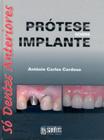 Livro - Prótese Sobre Implante - Só Dentes Anteriores
