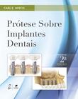 Livro - Prótese sobre Implantes Dentais