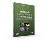 Livro Tomografia Computadorizada Por Feixe Cônico - Quintessence