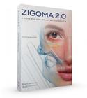 Livro Zigoma 2.0 - A nova era dos implantes zigomáticos - Giovanella - Napoleão - Napoleão/Quintessence