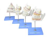 Modelo anatômico de desenvolvimento da dentição em 4 etapas sd5059g