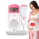 Monitor cardíaco fetal com medidor de batimentos ideal para gestantes - HIGA