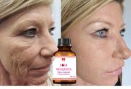 Óleo de Rosa Mosqueta Ajuda no Rejuvenescimento Capilar e Corporal 100ml  Dermachem - Óleo Corporal - Magazine Luiza