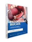 Patologias Bucais E Alterações Não Patológicas Mais Frequentes Em Odontologia - Editora Napoleão